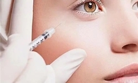 Hyaluronik Asit Lip Gel Enjeksiyonlar Göz kırışıkları Sentetik Hyaluronik Asit Dermal Dolgu