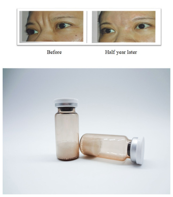 Enjekte edilebilir PLLA Poly-L-Lactic Acid Dermal Filler Yüz kırışıklıklarını kaldırır Kolajen Regenerasyonunu uyarır