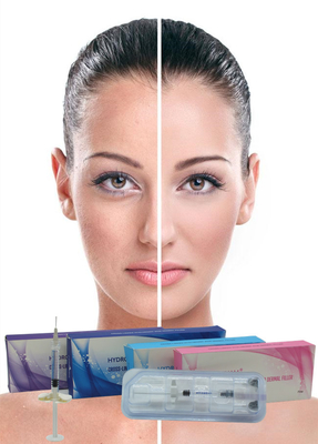 Profesyonel kırışıklık doldurucu 24mg/ml Yüz için Hyaluronik Asit Çapraz Bağlı Sodyum Hyaluronat Enjekte edilebilir
