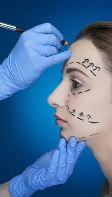 Yüz Dermi Dolguları ile Düz kırışıklıkları ve Jawline'i Açıklayın % 70 HA Çapraz Bağlantılı 24mg % 30 Kalsiyum Hidroksilapatit