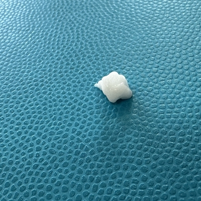 Kalsiyum Hidroksyapatit Enjeksiyonu ile Marionette Hatları Üzerine Gelişmiş Doldurma Etkisi