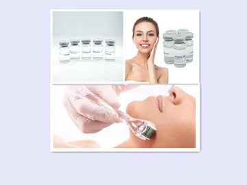 Plastik Cerrahi Çapraz Bağlı HA Dermal Filler 5ml Dudak Çevresindeki Kırışıklıklar Dolgu