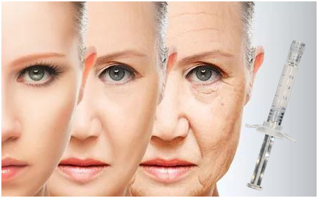 PCl Bazlı Hyaluronik Asit Enjeksiyon Ürünleri Serum Mucize Rötuş Cilt