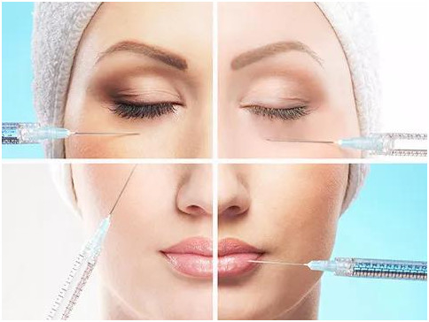Profesyonel kırışıklık doldurucu 24mg/ml Yüz için Hyaluronik Asit Çapraz Bağlı Sodyum Hyaluronat Enjekte edilebilir